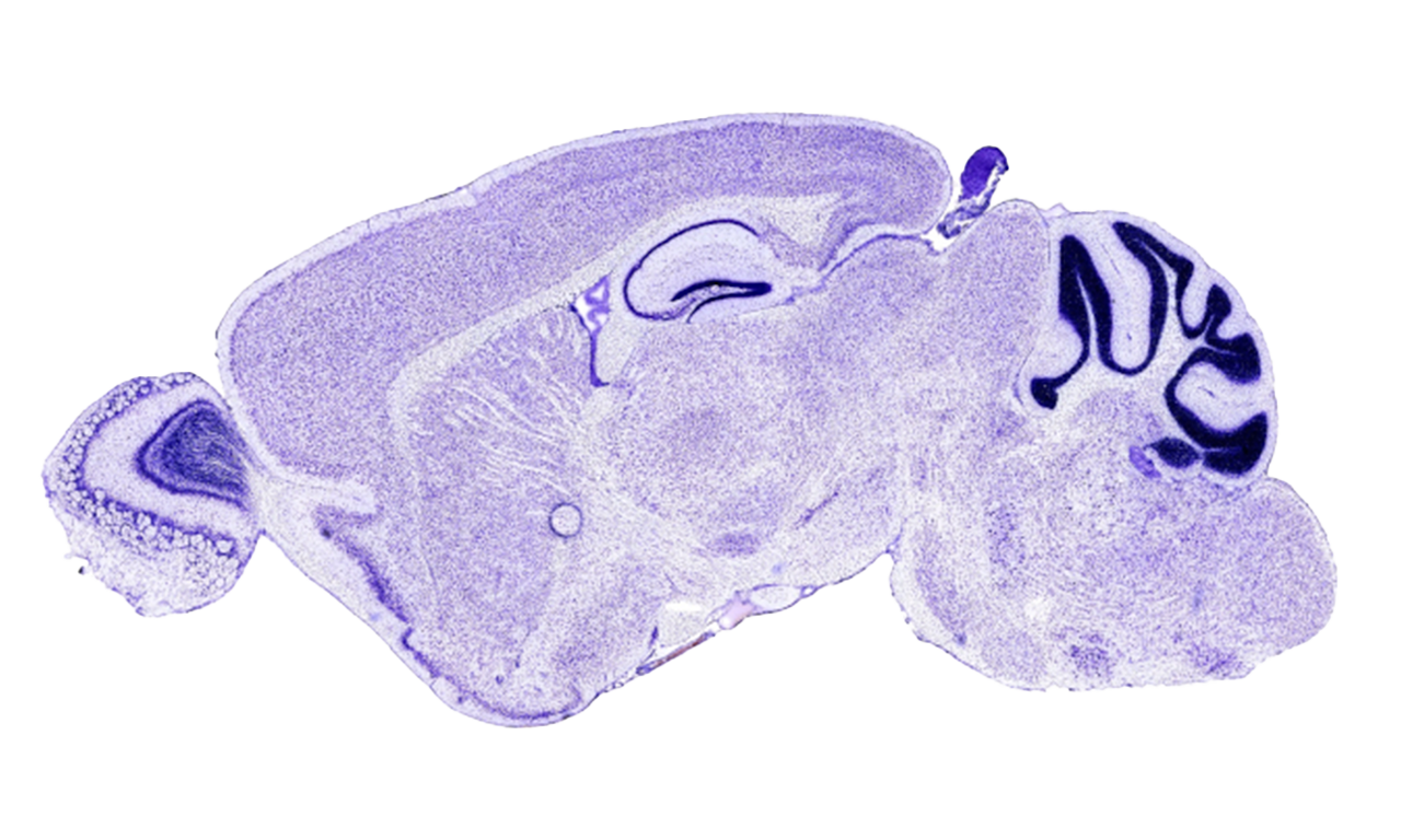 Automatic segmentation and localization of the hippocampus in histological images